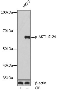 Phospho-AKT1-S124 Rabbit mAb