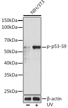 Phospho-p53-S9 Rabbit mAb