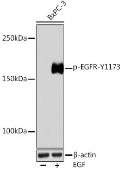 Phospho-EGFR-Y1173 Rabbit mAb