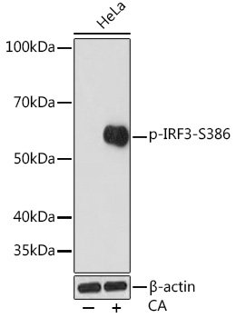 Phospho-IRF3-S386 Rabbit mAb