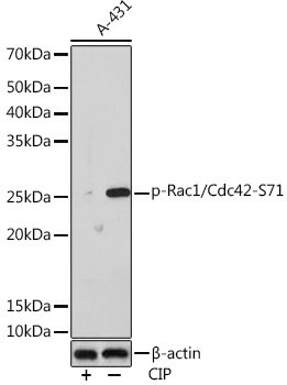 Phospho-Rac1/Cdc42-S71 Rabbit mAb