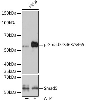 Phospho-Smad5-S463/S465 Rabbit mAb