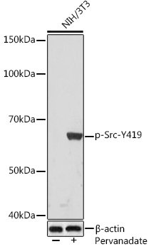 Phospho-Src-Y419 Rabbit mAb
