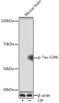 Phospho-Tau-S396 Rabbit mAb