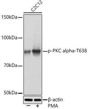 Phospho-PKC alpha-T638 Rabbit mAb