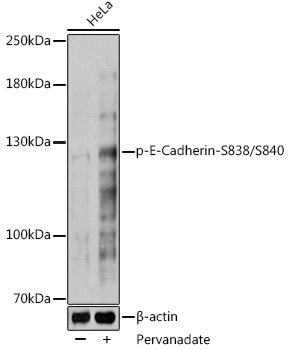 Phospho-E-Cadherin-S838/S840 Rabbit pAb