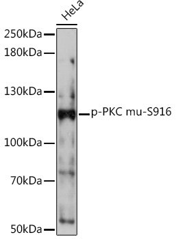 Phospho-PKC mu-S916 Rabbit pAb