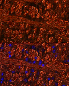 Phospho-Tau-Ser404 Rabbit pAb