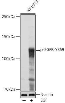 Phospho-EGFR-Y869 Rabbit pAb