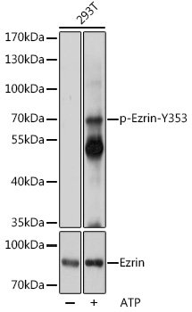 Phospho-Ezrin-Y353 Rabbit pAb
