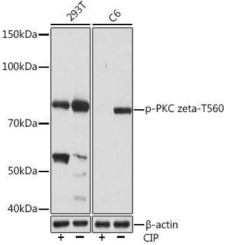 Phospho-PKC zeta-T560 Rabbit mAb