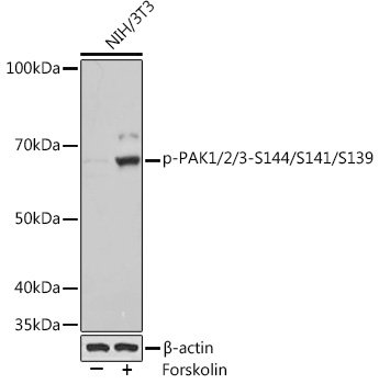 Phospho-PAK1/2/3-S144/S141/S139 Rabbit mAb