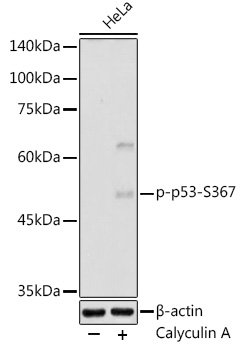 Phospho-p53-S367 Rabbit pAb