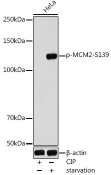 Phospho-MCM2-S139 Rabbit pAb