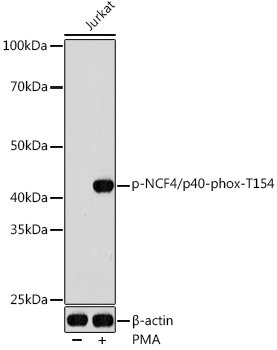 Phospho-NCF4/p40-phox-T154 Rabbit pAb