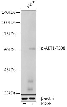 Phospho-AKT1-T308 Rabbit pAb