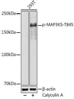 Phospho-MAP3K5-T845 Rabbit pAb