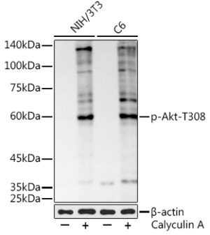 Phospho-Akt-T308 Rabbit mAb