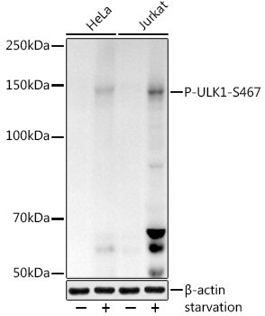 Phospho-ULK1-S467 Rabbit pAb