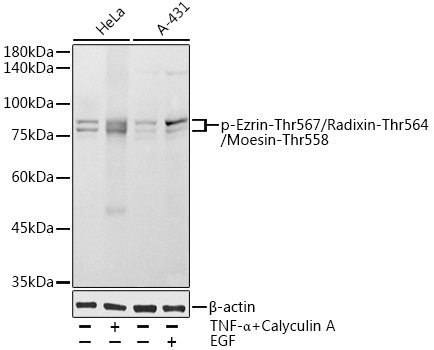 Phospho-Ezrin-Thr567/Radixin-Thr564/Moesin-Thr558 Rabbit pAb