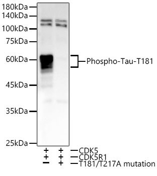 Phospho-Tau-T181 Rabbit mAb