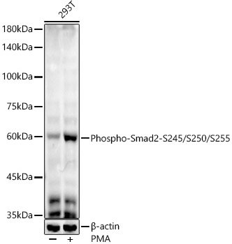 Phospho-Smad2-S245/S250/S255 Rabbit mAb