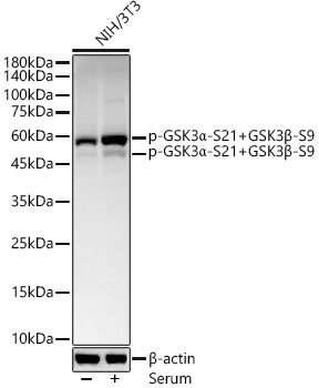 Phospho-GSK3α-S21+GSK3β-S9 Rabbit mAb