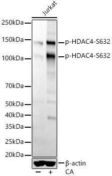 Phospho-HDAC4-S632 Rabbit mAb