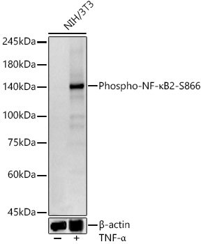 Phospho-NF-κB2-S866 Rabbit mAb