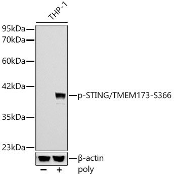 Phospho-STING/TMEM173-S366 Rabbit mAb