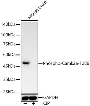 Phospho-Camk2-T286 Rabbit mAb
