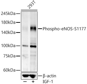 Phospho-eNOS-S1177 Rabbit mAb
