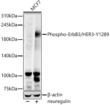 Phospho-ErbB3/HER3-Y1289 Rabbit mAb