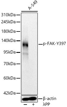 Phospho-FAK-Y397 Rabbit mAb
