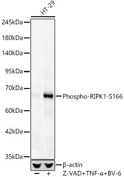 Phospho-RIPK1-S166 Rabbit mAb