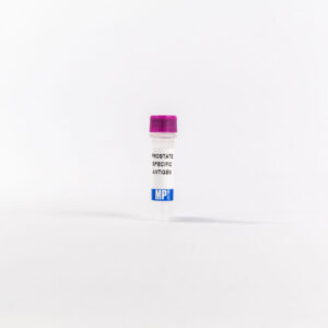 Prostate Specific Antigen