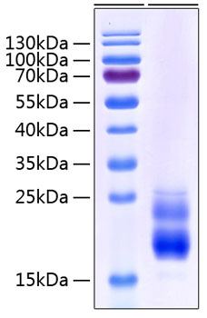 Recombinant Human CD69 Protein