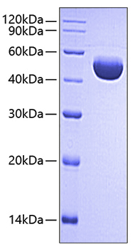 Recombinant Human Serpin E1/PAI-1 Protein