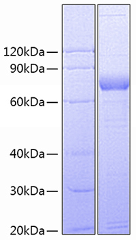 Recombinant Human SIRP-gamma/CD172g Protein