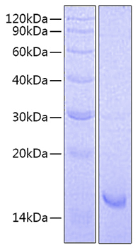 Recombinant Mouse IL-21 Protein