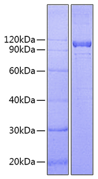 Recombinant Human IL-12 R beta 1/CD212 Protein