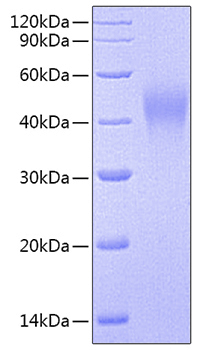 Recombinant Human Alkaline phosphatase (Intestinal type)/ALPI Protein