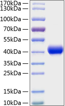 Recombinant Mouse CXCL16/SR-PSOX Protein
