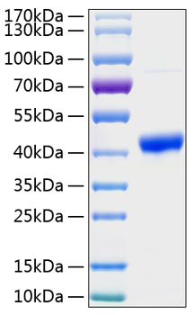 Recombinant Human Zinc-alpha-2-glycoprotein/AZGP1 Protein