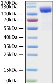Recombinant Human DPP4/CD26 Protein