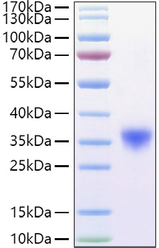 Recombinant Mouse Fc-gamma RIV/FCGR3A/CD16a Protein