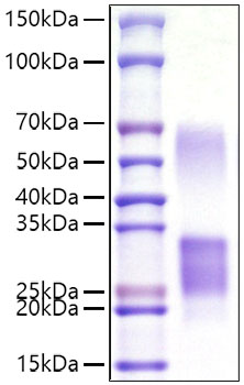 Recombinant Mouse CD69 Protein