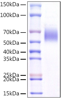 Recombinant Mouse IL1RL1/ST2 Protein