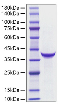 Recombinant Human PG II(PGC) Protein
