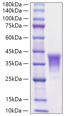 Recombinant Human TNFSF8/CD30 Ligand/CD153 Protein